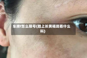 车牌f怎么限号(脸上长黄褐斑看什么科)