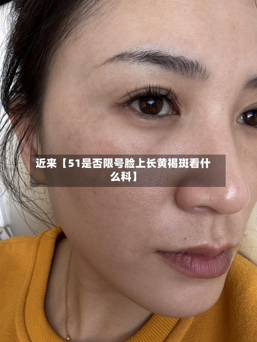 近来【51是否限号脸上长黄褐斑看什么科】-第1张图片